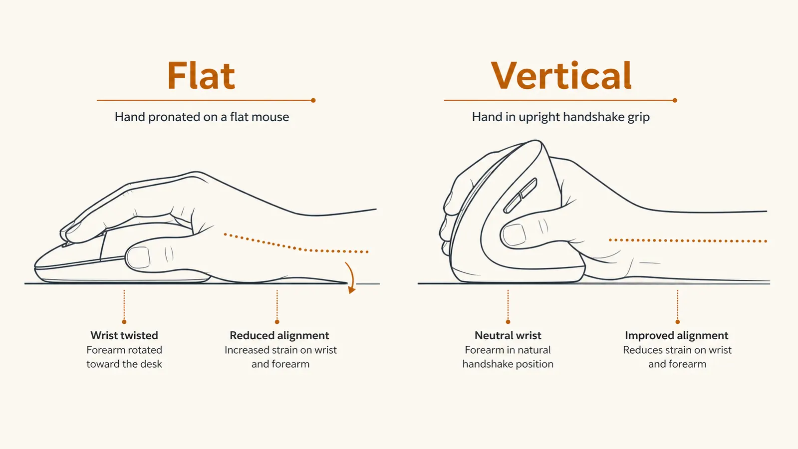 A side-by-side diagram of a hand on a flat mouse palm down with the wrist twisted, compared to a hand on a vertical mouse in an upright handshake grip.